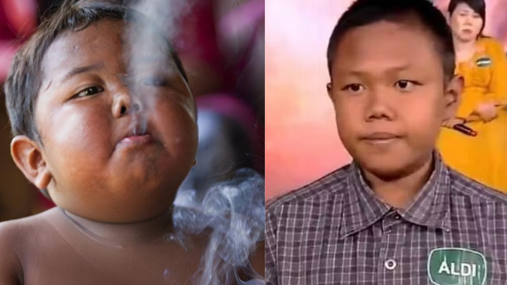 Antes e depois de Ardi Rizal