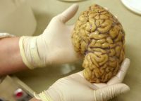 Cientistas mapeiam atividade gênica no córtex pré-frontal do cérebro, em busca de repostas para Alzheimer, Parkinson e esquizofrenia