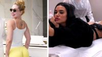 Entenda riscos de harmonização nos glúteos, queridinho entre as blogueiras