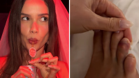 Juliette mostra hematomas após despedida de solteira: "Fim do mundo"