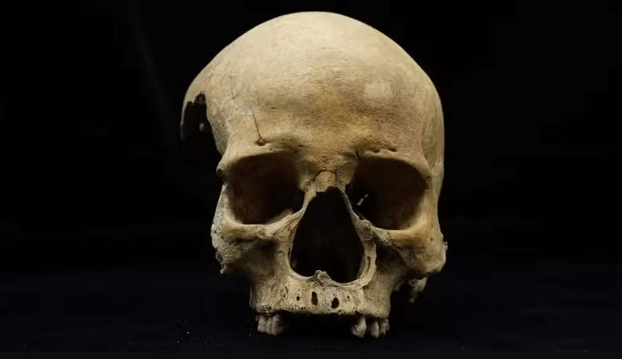Há 700 anos, mulher teve o nariz amputado por ter cometido um crime ou adultério. Ela sobreviveu anos e quando morreu foi enterrada de bruços