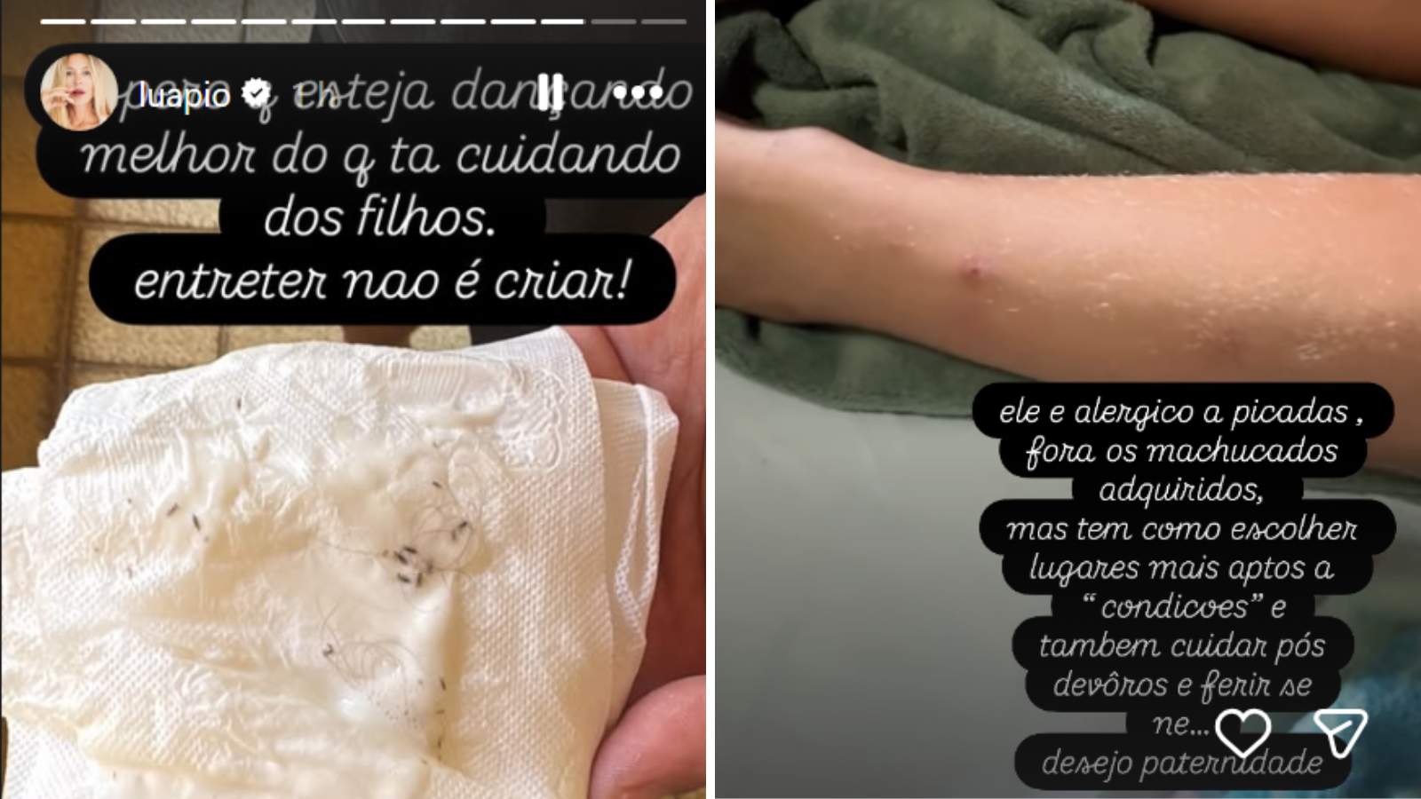 Luana Piovani exp&otilde;e piolhos e machucados dos filhos &bull; Instagram/ Luana Piovani