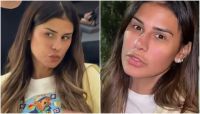 Simone Mendes nega ter feito rinoplastia e rebate comentários