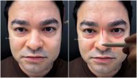 Aos 34 anos, Yudi Tamashiro faz harmonização facial; veja antes e depois