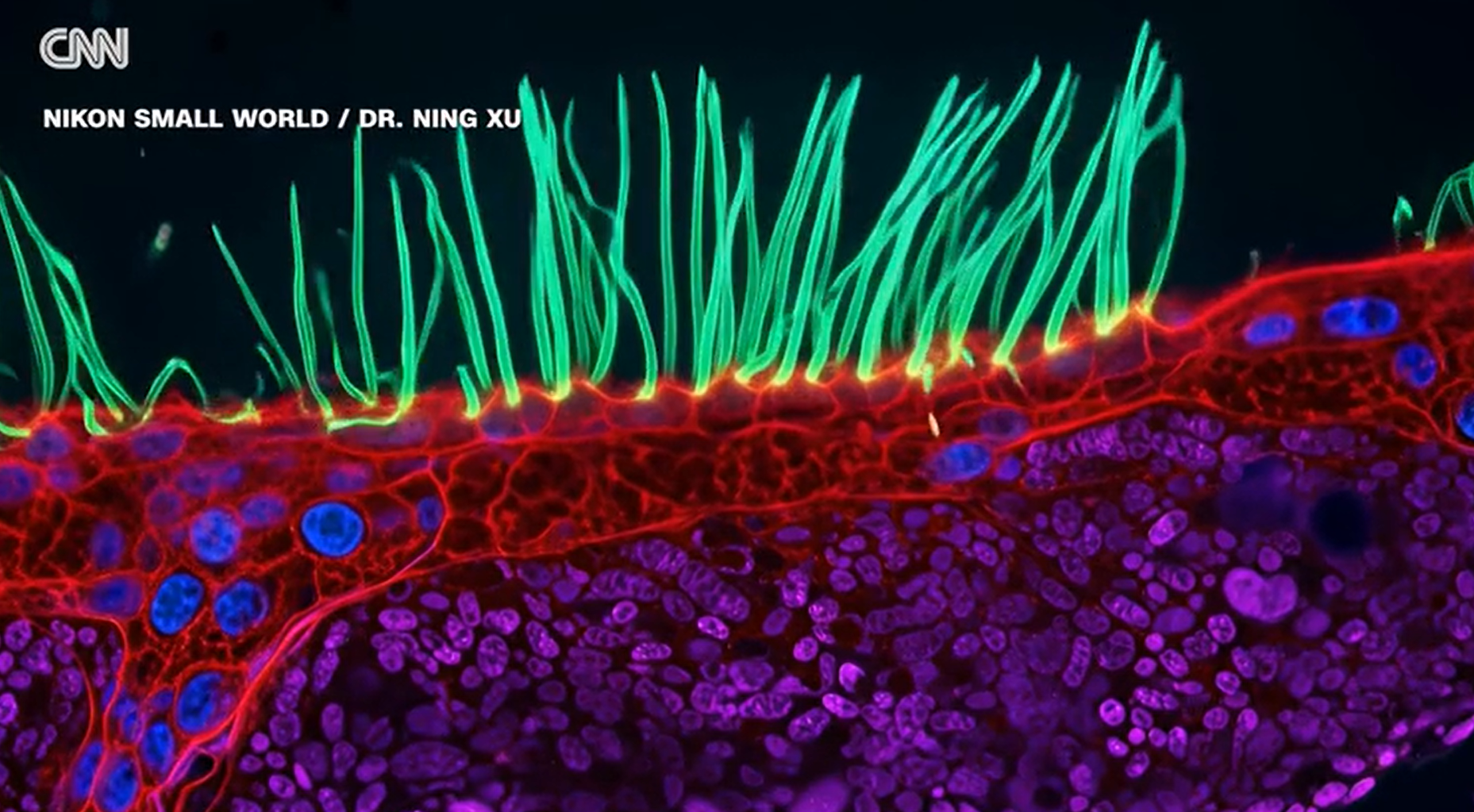Vencedor de concurso de fotografia de microscopia