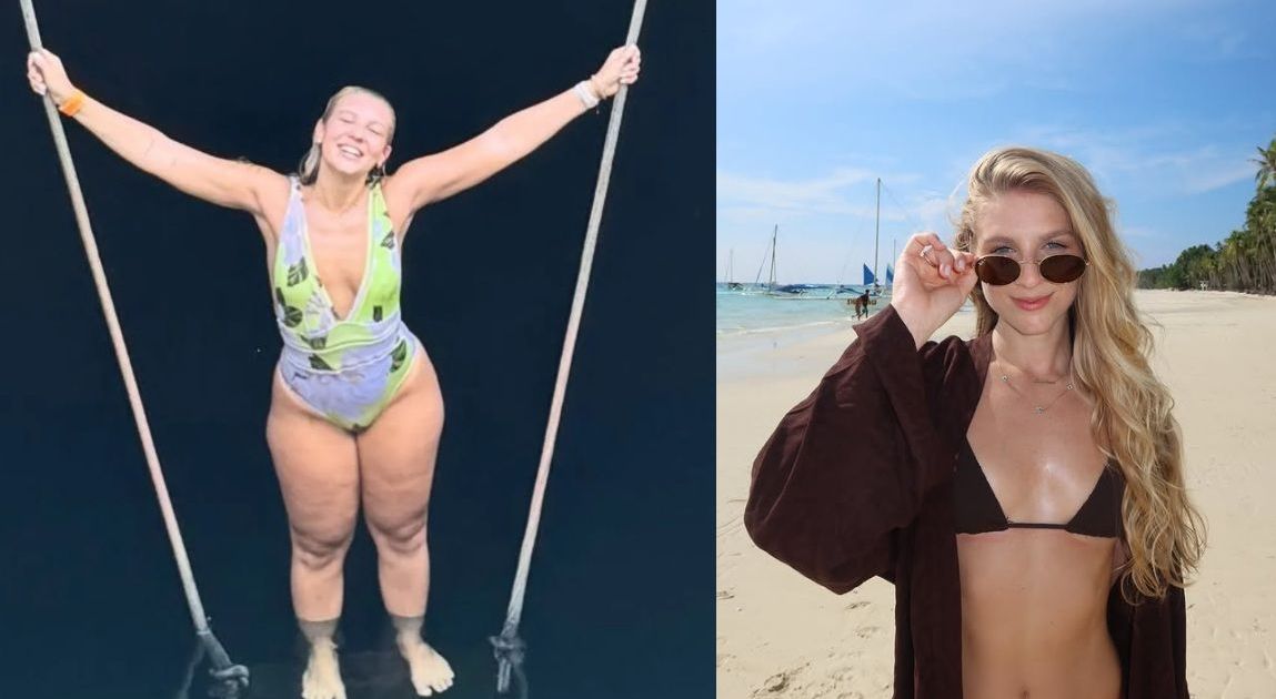 Lauren Pfeiff relata um ano de cirurgia de lipedema: "Impacto positivo" | CNN Brasil