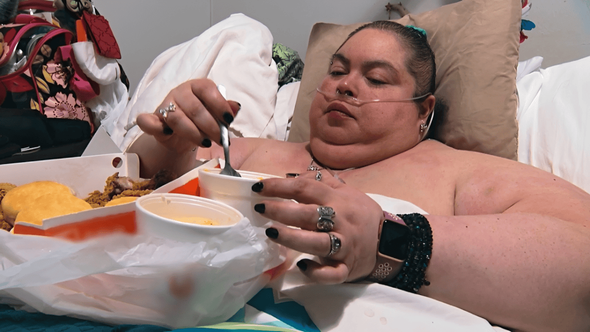 Lauren Pfeiff relata um ano de cirurgia de lipedema: “Impacto positivo”