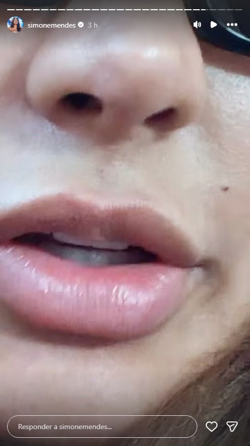 Cantora reforçou que não fez rinoplastia • Reprodução/Instagram/Simone Mendes