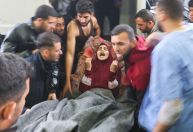Mais de 10 crianças perdem uma ou as duas pernas por dia em Gaza, diz instituição