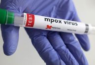 São Paulo registra primeiro caso de nova cepa de mpox no Brasil