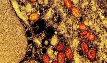 Mpox: Brasil registra 945 casos desde o começo do ano e ultrapassa marca de 2023